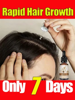 Масло за растежа на косата Унисекс за мъже и жени Бързо Прераждане Ефективно Лечение на Наследствено Оплешивяване Средство срещу косопад
